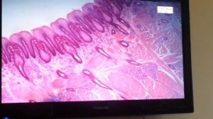 Гистология  Препарат  Листовидные сосочки языка  Окраска  Гематоксилин+эозин  ча