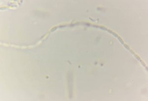 Листерия под Микроскопом