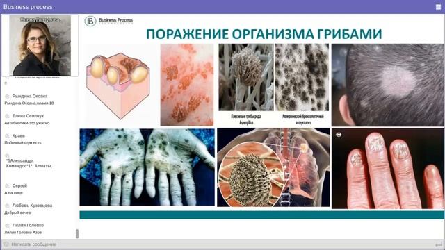 Грибковые инфекции. Как с ними справиться?