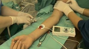 Блокада плечевого сплетения (подмышечная блокада 2)