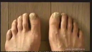 Реклама Galderma