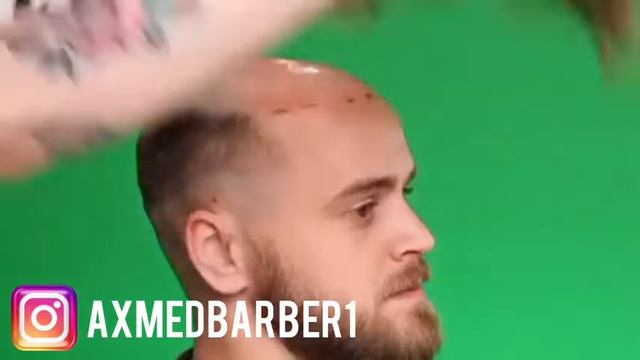 Мужские парики. Система волос. Интеграция волос. Алопеция. Муи сар часпондан. Казахстан. Таджикиста