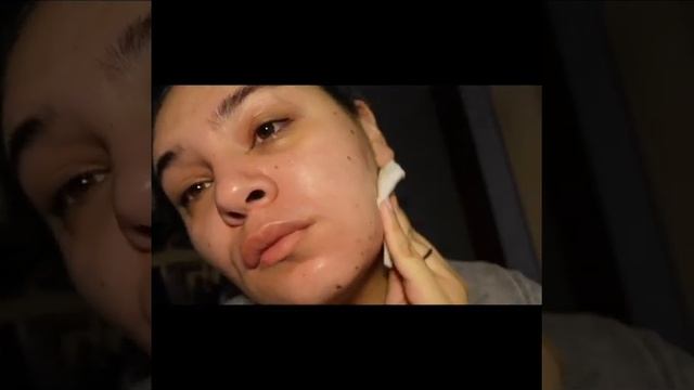 Miriam Quevedo skincare Review Fail- 2 Week Review fail, Skincare смотреть онлайн