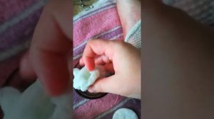 Что делать если укусил кот?