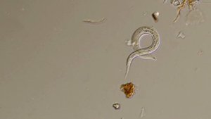 Наглядная микробиология #15 Нематоды (Nematode)
