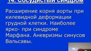 Синдром дисплазии соединительной ткани. Жукова Л.А.