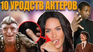 АКТЕРЫ С ДЕФЕКТАМИ ВНЕШНОСТИ|УРОДСТВА АКТЕРОВ