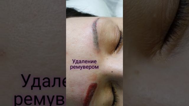 Удаление татуажа ремувером DM Art смотреть онлайн