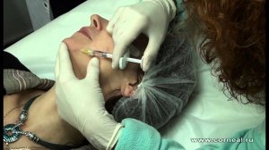 Учимся делать биоревитализацию