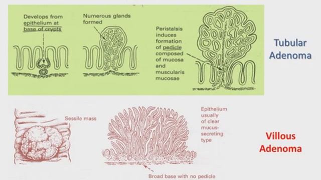 Pathology git large I смотреть онлайн