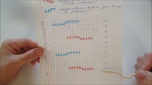 Узоры спицами: Косы и жгуты. Принцип вязания кос и жгутов.