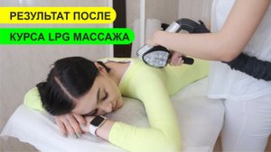 LPG массаж. Результаты после курса LPG массажа. Фото до/после. Акция на LPG в Москве.