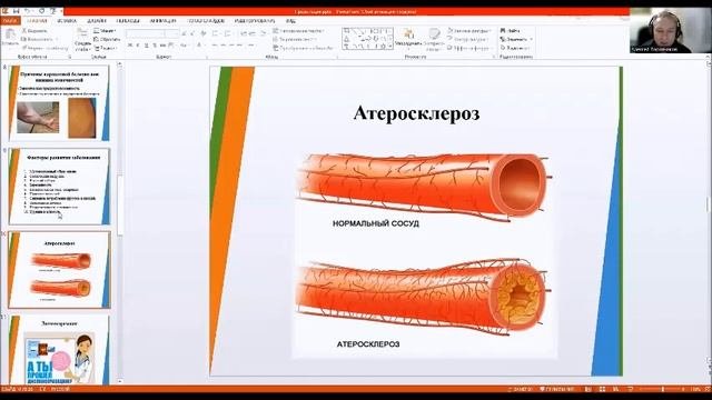Лекция 19. Варикозная болезнь вен нижних конечностей. Атеросклероз.