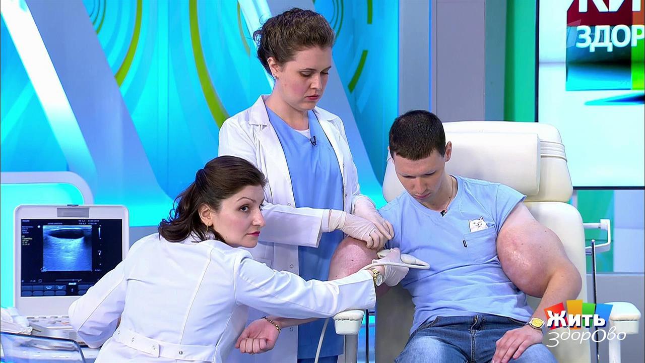 Руки-базуки: продолжение истории. Жить здорово! Фрагмент выпуска от 22.08.2018 смотреть онлайн