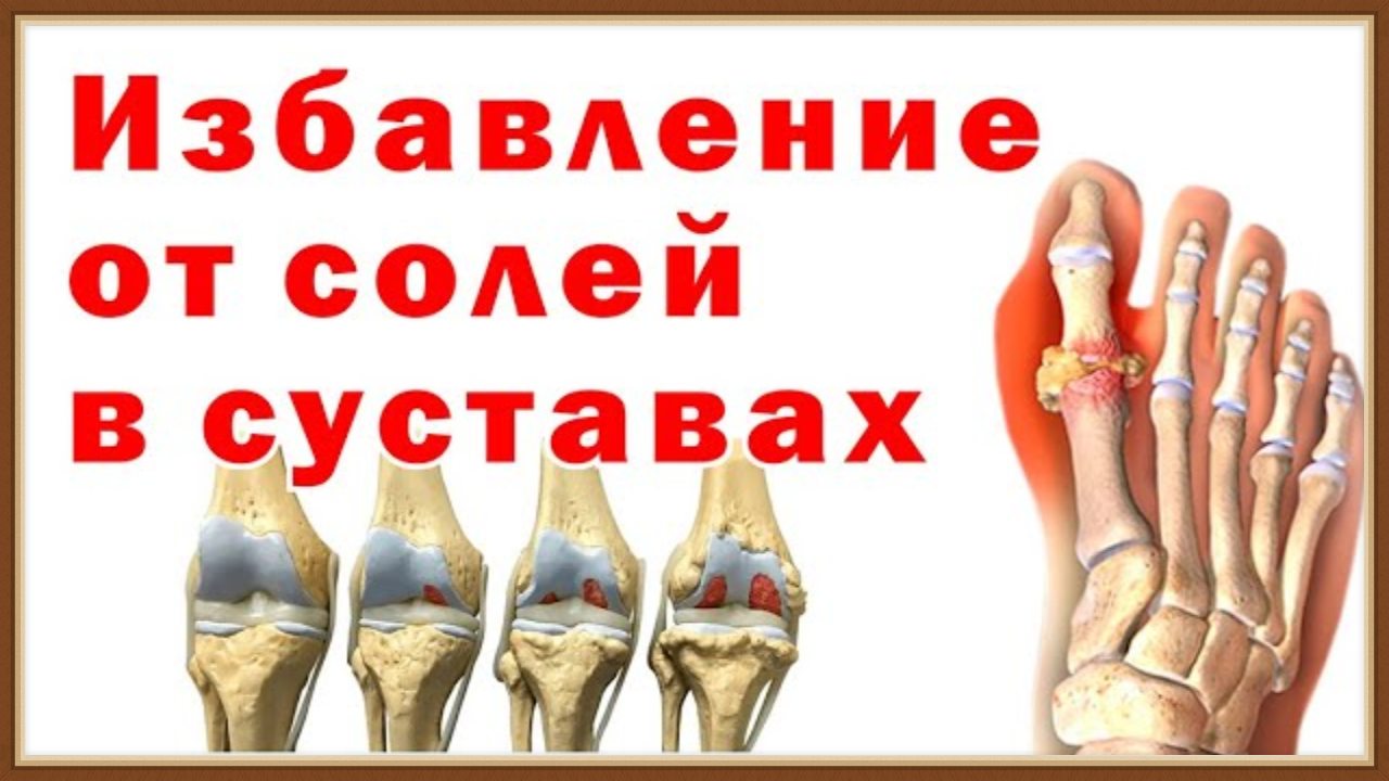 ОЧИЩЕНИЕ ОРГАНИЗМА ОТ СОЛЕЙ
