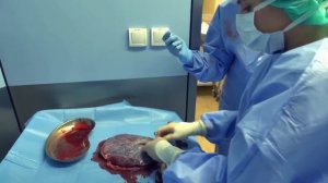 Учебный фильм по забору пуповинной и плацентарной крови, шнура пуповины.