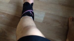 Трехлодыжечный перелом