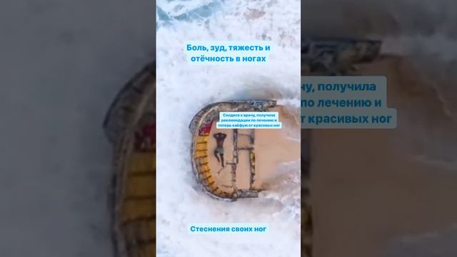 Боль, зуд, стеснения своих ног, отёчность, появились вены - знакомо? Запишись на приём к врачу ✍🏻