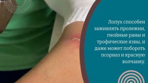 Эти травы в 5 раз лучше химии для суставов. Это лекарство есть на любом огороде!