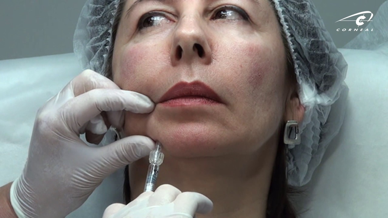 Обучение контурной пластики. Для коррекции важна причина дефекта. смотреть онлайн