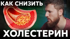 Как снизить ХОЛЕСТЕРИН, избавляемся от атеросклероза