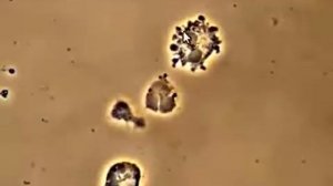 ПАРАЗИТЫ ЖИВУТ ВНУТРИ НАС Bacteria attacking White Blood Cells