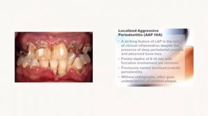 Part III Antimicrobial DRUGS