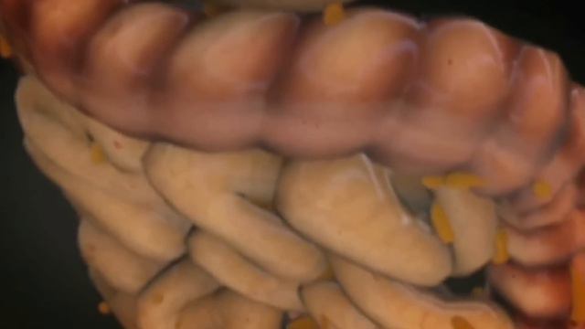 ୬ ମସର ଥର ଖଆନତ ପଟର ପକ ମଳ ବଟ ବହର ଯବ  Worms in Stomach Home Remedies