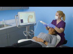 Техника внутриротового сканирования