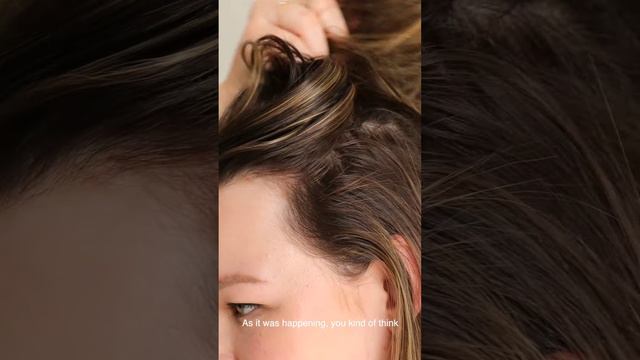 Thinning Hair Solution ｜ Post-Partum Hair Loss