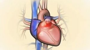 Сердечная недостаточность