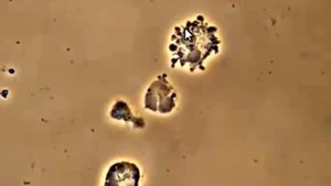Bacteria attacking White Blood Cells