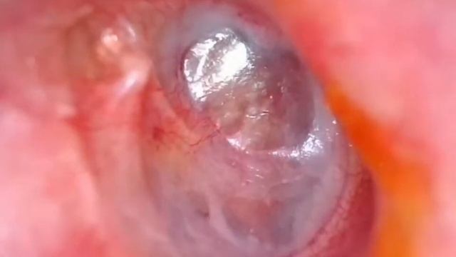 щёлкает в ухе смотреть онлайн