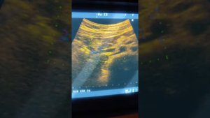 Практическое занятие 4. УЗИ органов брюшной полости (Неласов Н.Ю.)