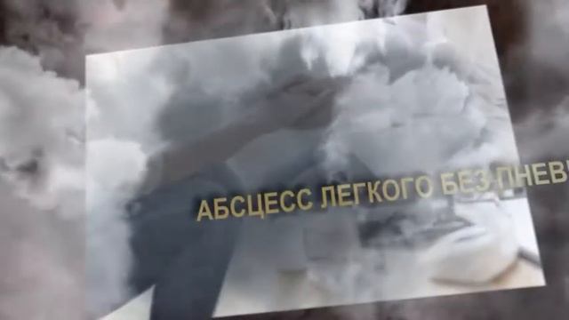 Заразна ли пневмония правосторонняя смотреть онлайн