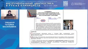 История изучения желудочковых аритмий при ишемической болезни сердца ...