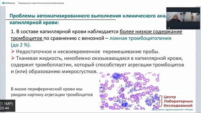 низкие тромбоциты #псевдотромбоцитопения #холодоваяАгглютинация