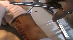 Хирургические непрерывные швы. Docent A.D. Stepanov, ПДАТУ