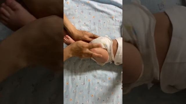 Дисплазияға массаж жасау.Массаж дисплазии тазобедренного сустава.