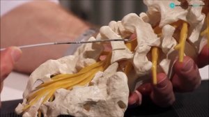 Хронические БОЛИ В СПИНЕ. Мнение немецкого профессора. Фасеточный  синдром.