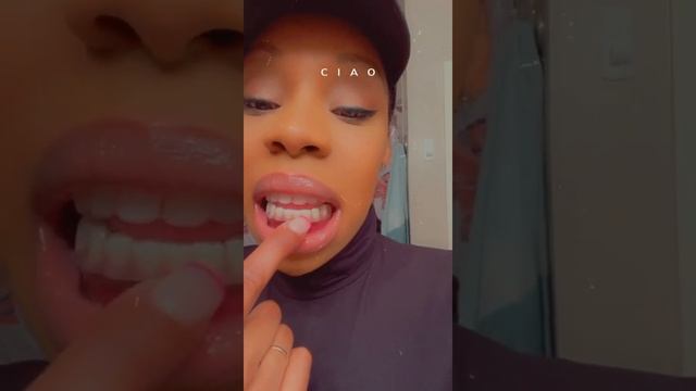 **Vlog** Quick Smile direct club review смотреть онлайн