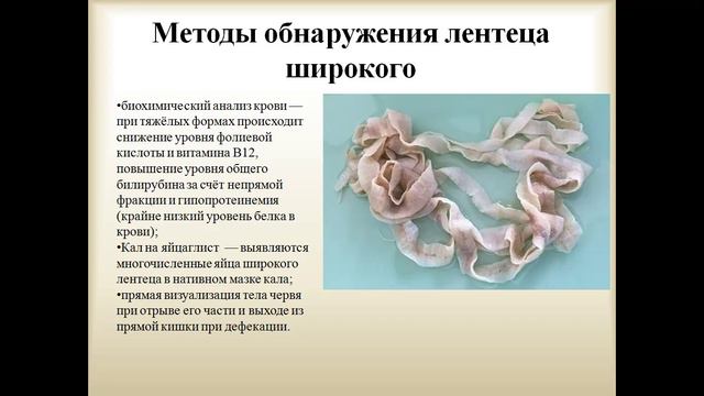 Общая гельминтология