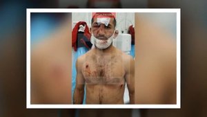 Расул Мирзаев в больнице