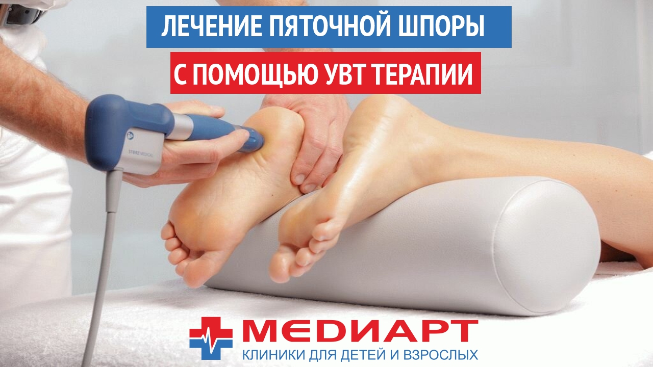 Лечение пяточной шпоры с помощью УВТ терапии..mp4