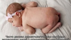 Сыпь в паху у ребенка — причины появления высыпаний