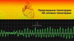 Предсердные тахикардии. АВ узловые тахикардии.