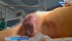 Ставропольчанка довела себя до последней стадии рака, доверившись знахарке