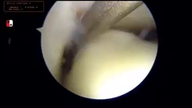 LODA 3 смотреть онлайн