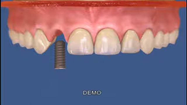 Ортодонтия смотреть онлайн