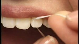 How to Properly Floss Your Teeth by Hermosa Beach Dentist Dr. Mondavi